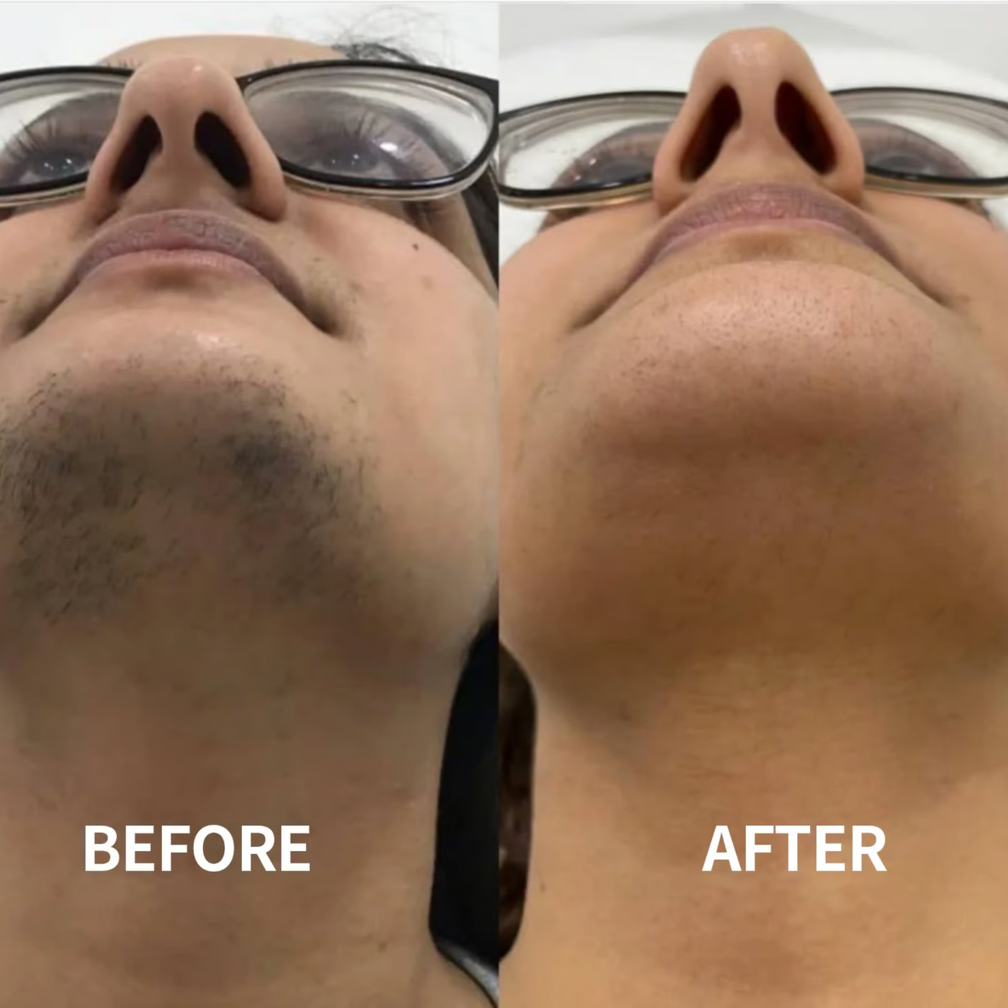 Kissede™ - Painless Facial Hair Removal Cream