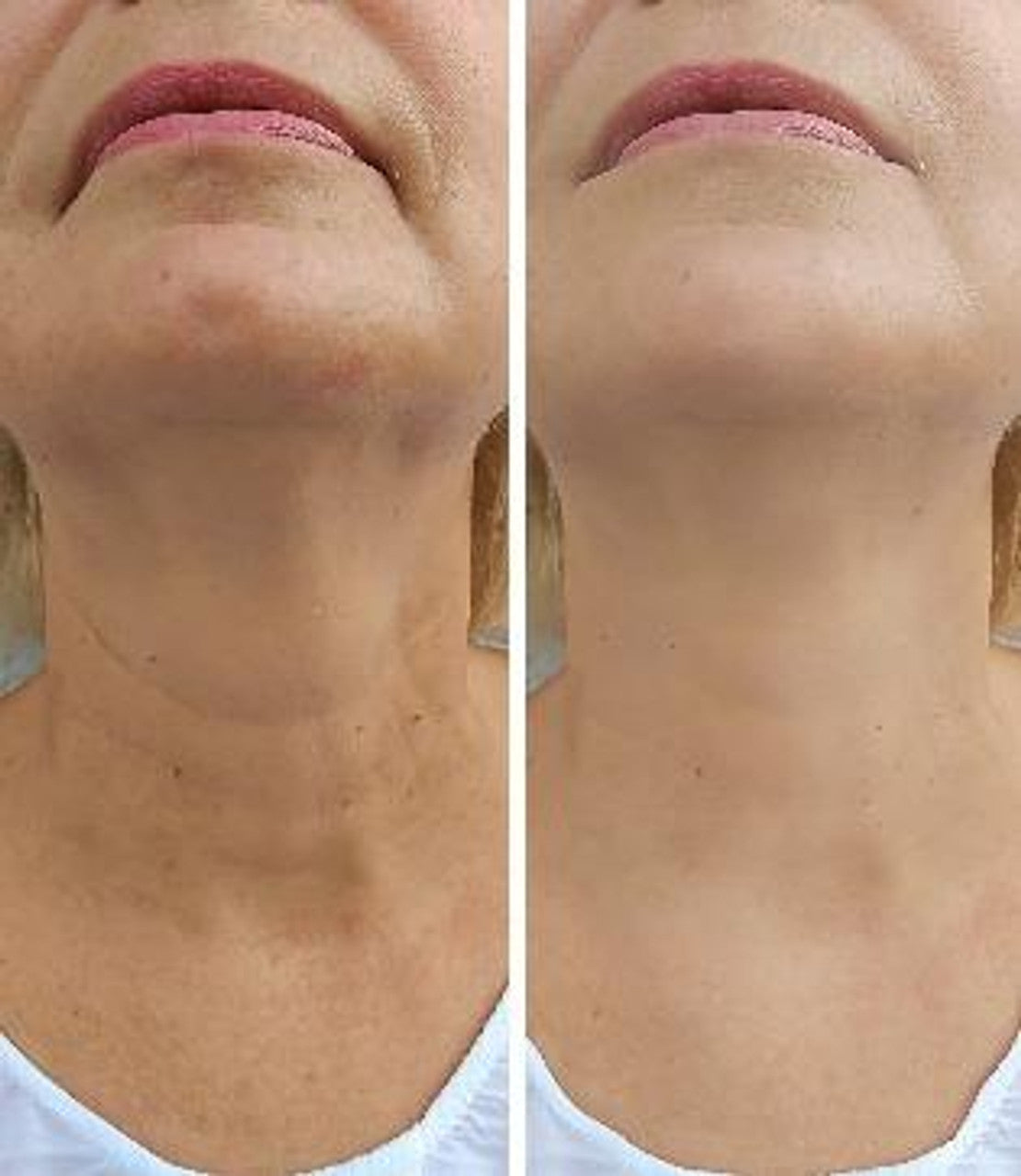 files/versalift-firming-neck-cream-for-sagging-skin__88601.jpg